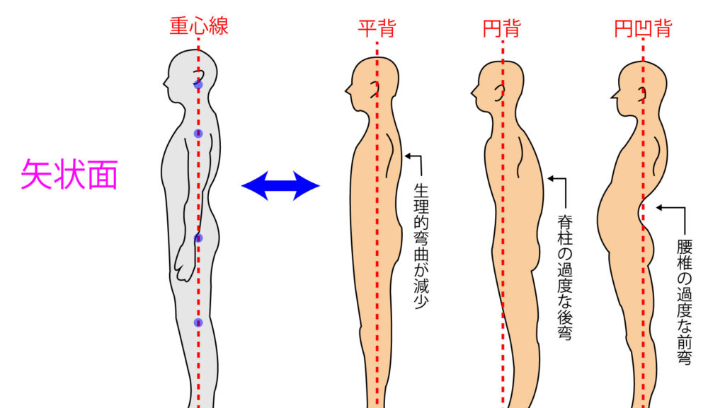 ウェルネス鍼灸整骨院の姿勢矯正